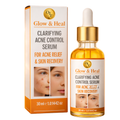 Clarifying Acne Control Face Serum for Effective Acne Relief and Skin Recovery – 30ml