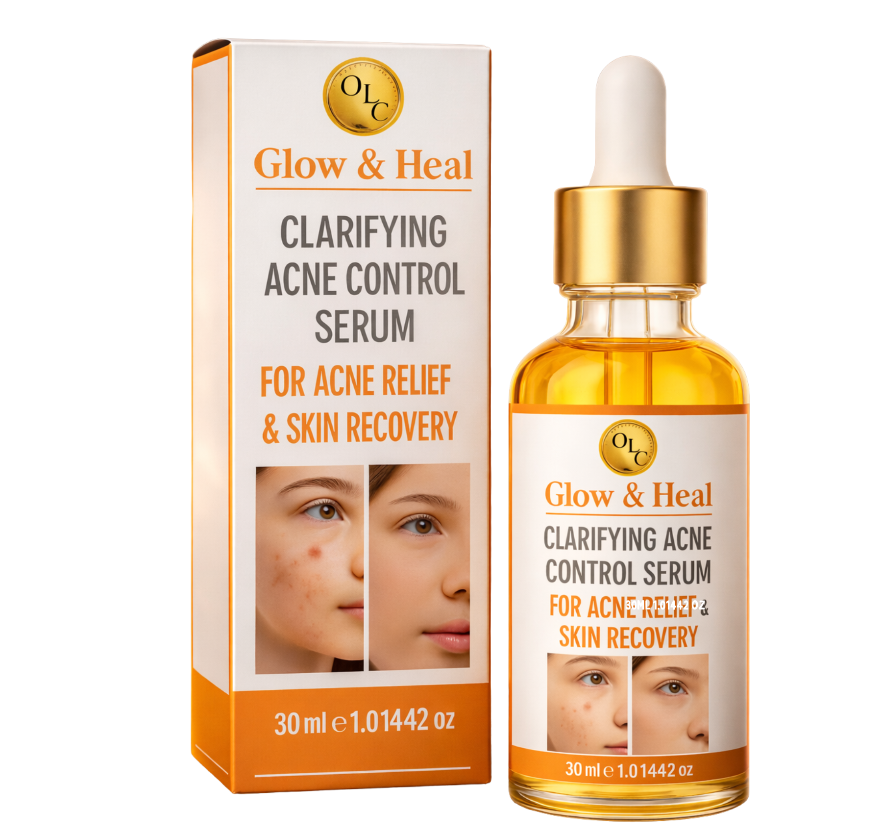 Clarifying Acne Control Face Serum for Effective Acne Relief and Skin Recovery – 30ml